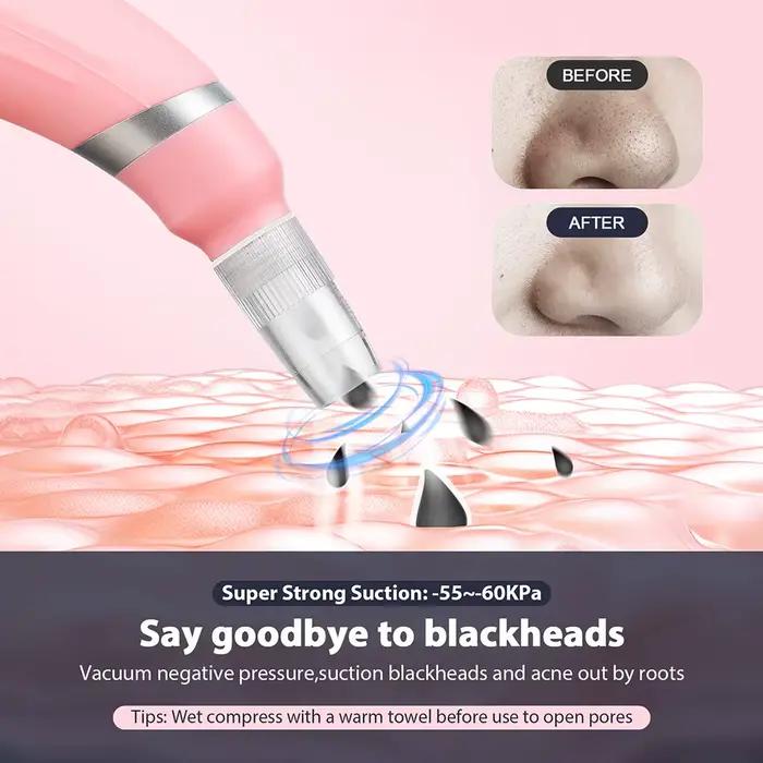 Appareil de peeling facial anti-âge Diamond MicrodermDelhi, élimination des points noirs, tonificati