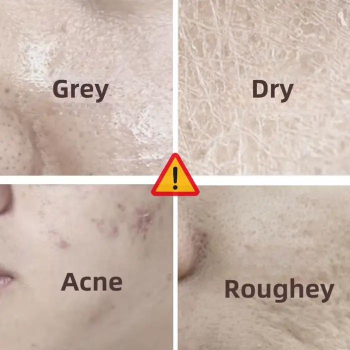 Crème hydratante apaisante et adoucissante 80g, hydratante, verrouillage à l'eau à Long terme, réparation, crème spéciale sèche et sensible pour le visage