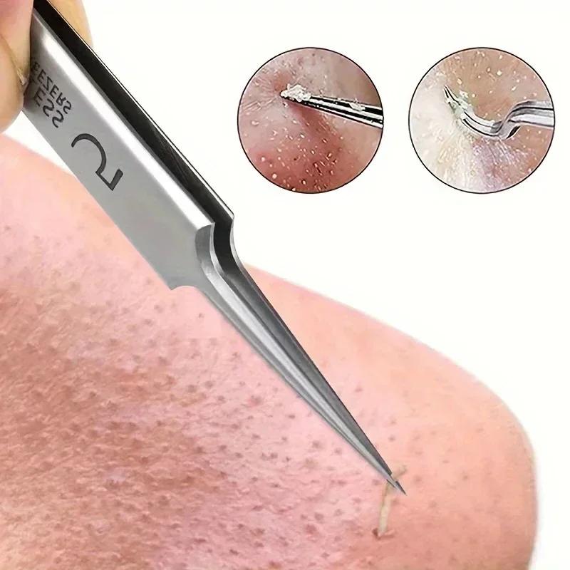 Pince extra fine n ° 5 pour les soins de la peau, accessoire pour éliminer l'acné, les points noirs,
