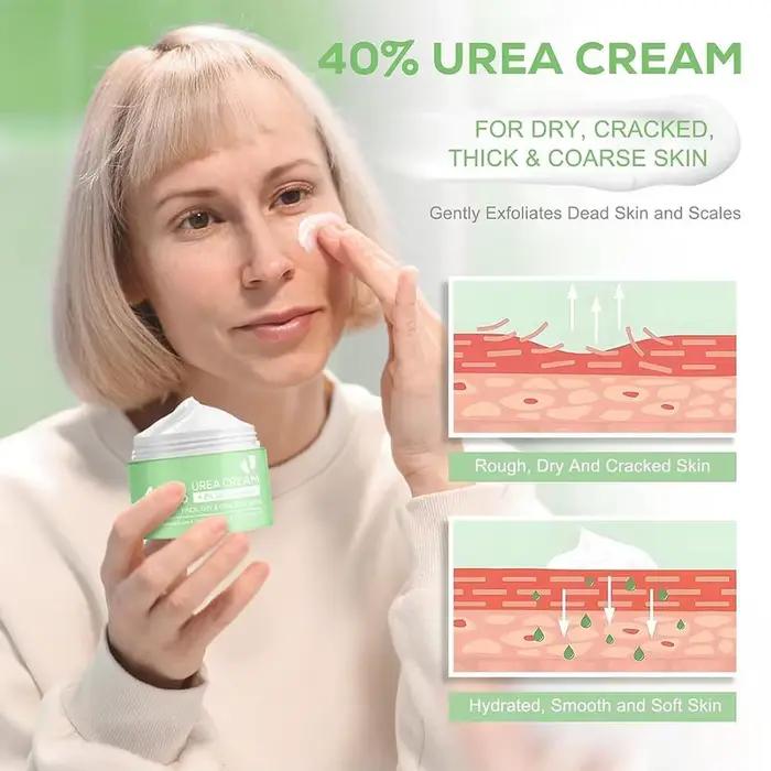 Crème à l'urée à 40% pour les mains et les pieds