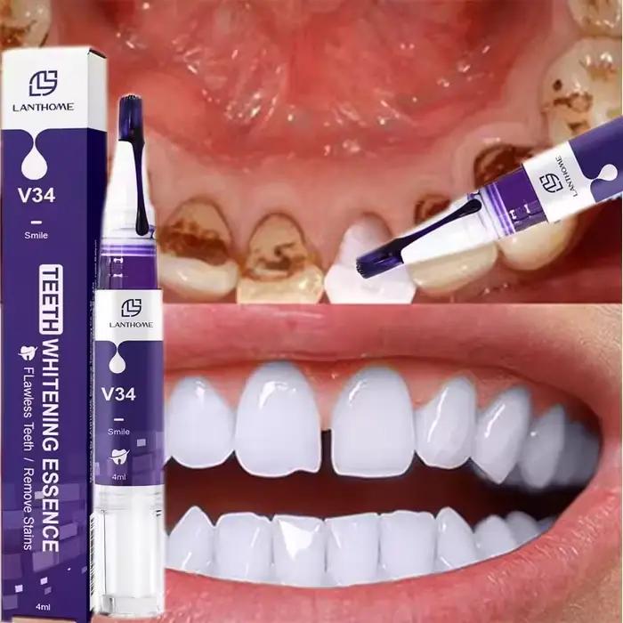 Nettoyage des dents dentifrice blanchissant Gel blanchissant blanchissant élimine les taches haleine