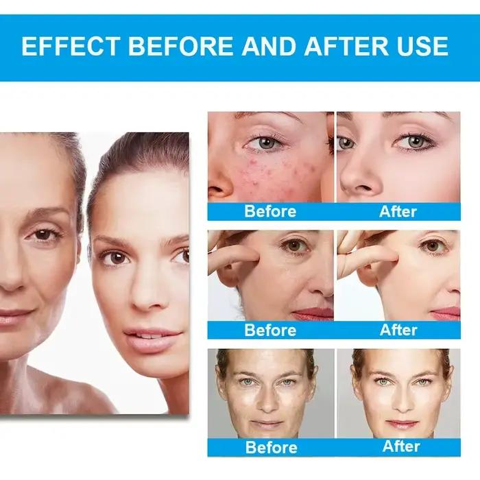 Tiroir AO Peel Water Glycolic Face Serum Expecate et Minimise les Pores