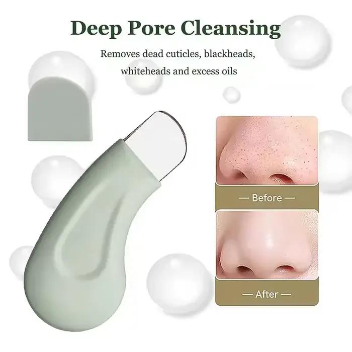 Outil d'élimination des points noirs et des points blancs pour le nez et le visage – Nettoyant pour