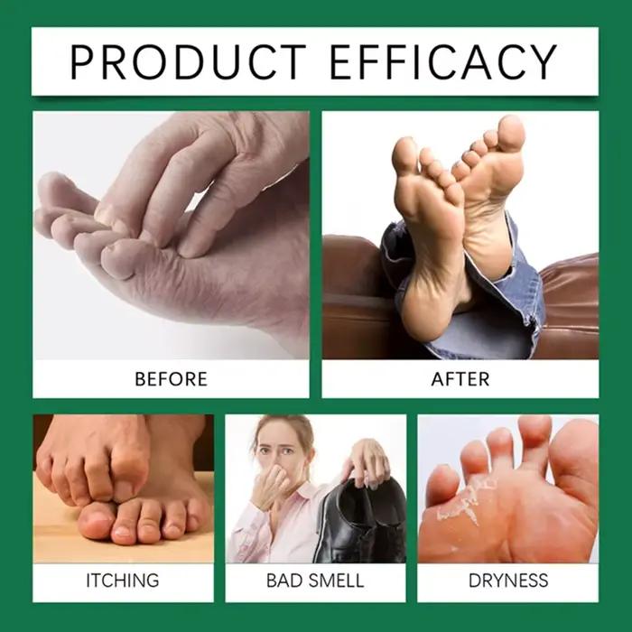 Spray pour les pieds 100 ml