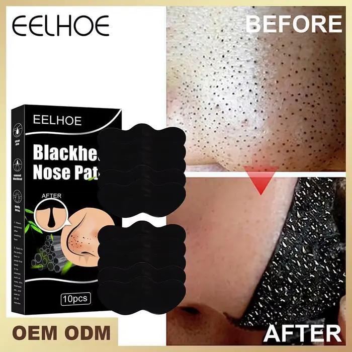 Peel Off points noirs supprimer les bandes de nez de plâtre tirer le masque noir pour la beauté des
