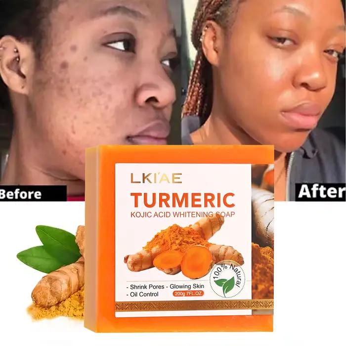 Crème blanchissante naturelle au curcuma pour le corps