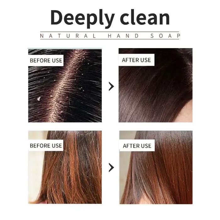 Le shampooing végétal à l'huile essentielle d'arbre à thé est rafraîchissant, contrôlant l'huile, réduisant les pellicules et fort pour les cheveux. Shampoing fait main wi