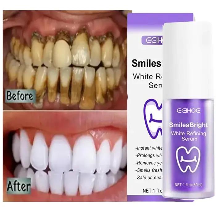 Nettoyage des dents dentifrice blanchissant Gel