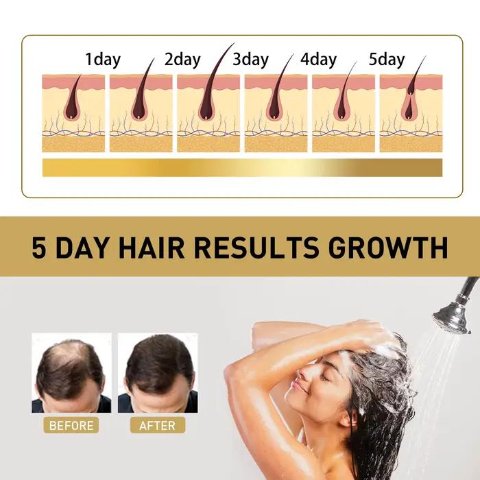 Shampoing de repousse au gingembre