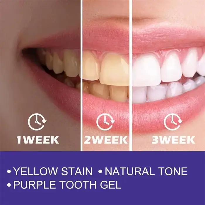 Nettoyage des dents dentifrice blanchissant Gel