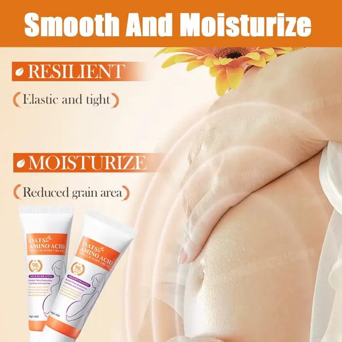Crème anti-vergetures, lignes lumineuses, obésité post-partum, grossesse, Absorption rapide puissante
