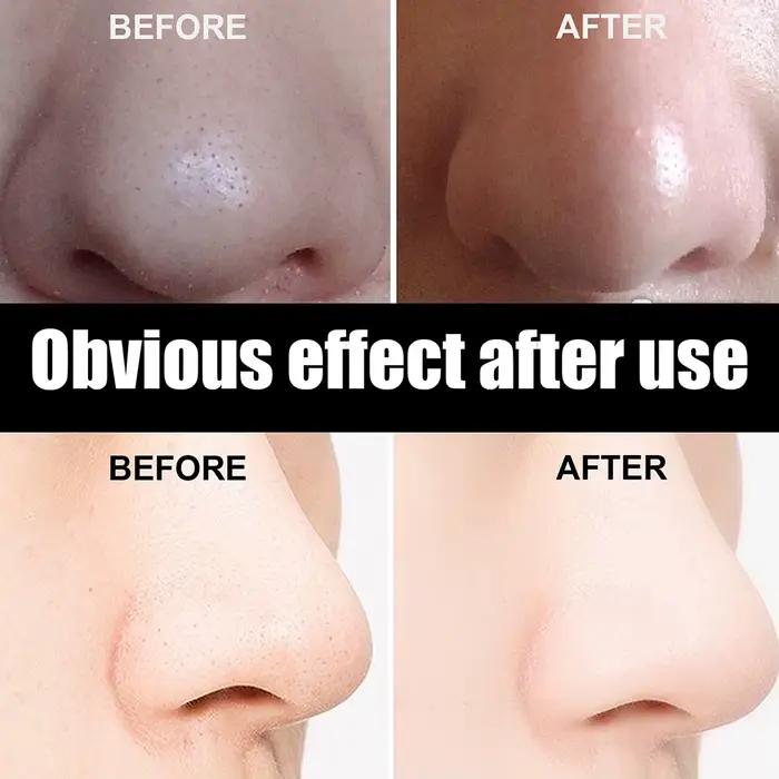 Peel Off points noirs supprimer les bandes de nez de plâtre tirer le masque noir pour la beauté des femmes
